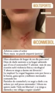 Pollet publicou imagem de agressão de Piero Maza nas redes sociais - Foto: Reprodução / Instagram