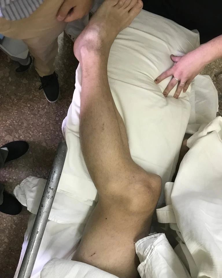 Imagem do joelho de Luciano Sánchez após o lance. Foto: Reprodução/La Red
