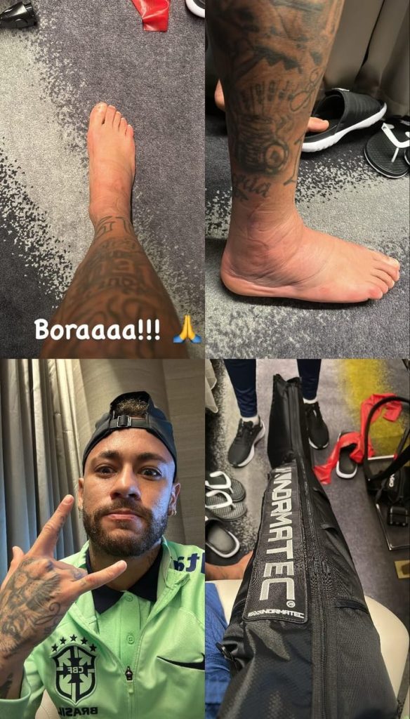 Neymar publica foto do tornozelo lesionado no Instagram. Foto: Reprodução/Instagram