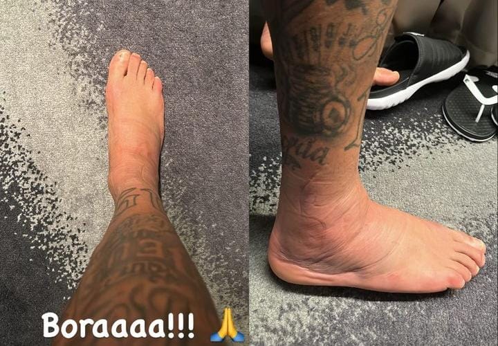 Neymar publica foto do tornozelo lesionado no Instagram. Foto: Reprodução/Instagram